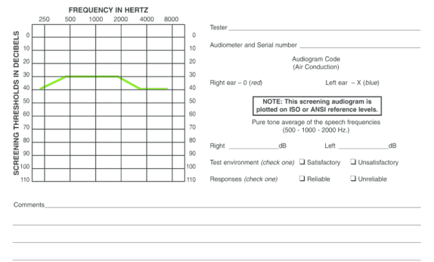 Blank Audiogram - Fill Online, Printable, Fillable, Blank throughout Blank Audiogram Template Download