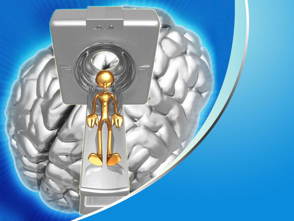 Brain Powerpoint Presentation Templates Free Powerpoint Regarding Radiology Powerpoint Template