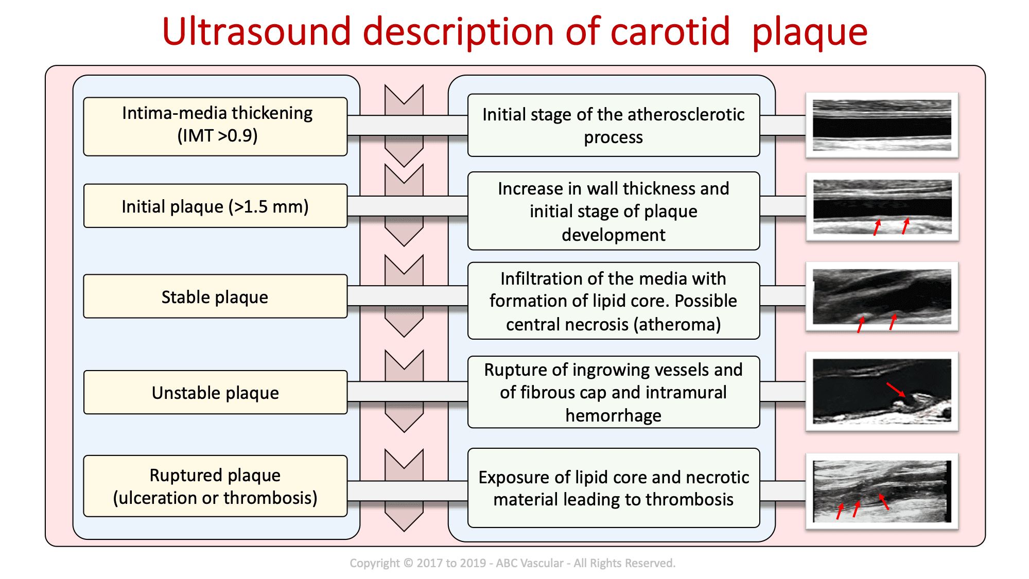 Carotid Course Info | Abc Vascular Throughout Carotid Ultrasound Report Template